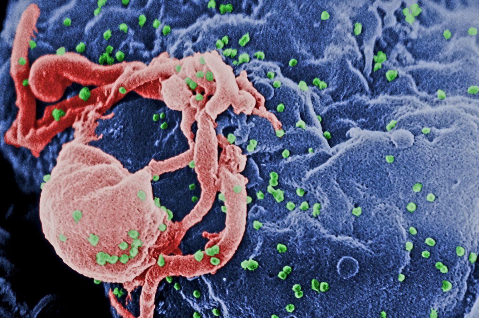 HIV: Scientists cleared the HIV virus from the Cells